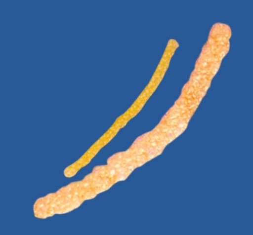 Loading Image