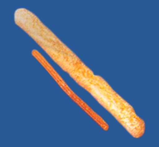 Loading Image